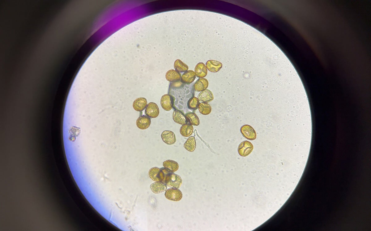 Multiple yellow spots with a white background.