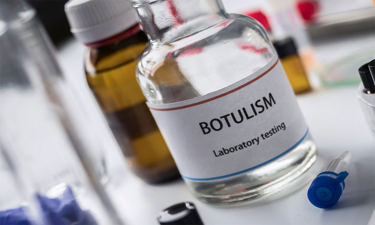 Botulism testing supplies arranged in a lab.