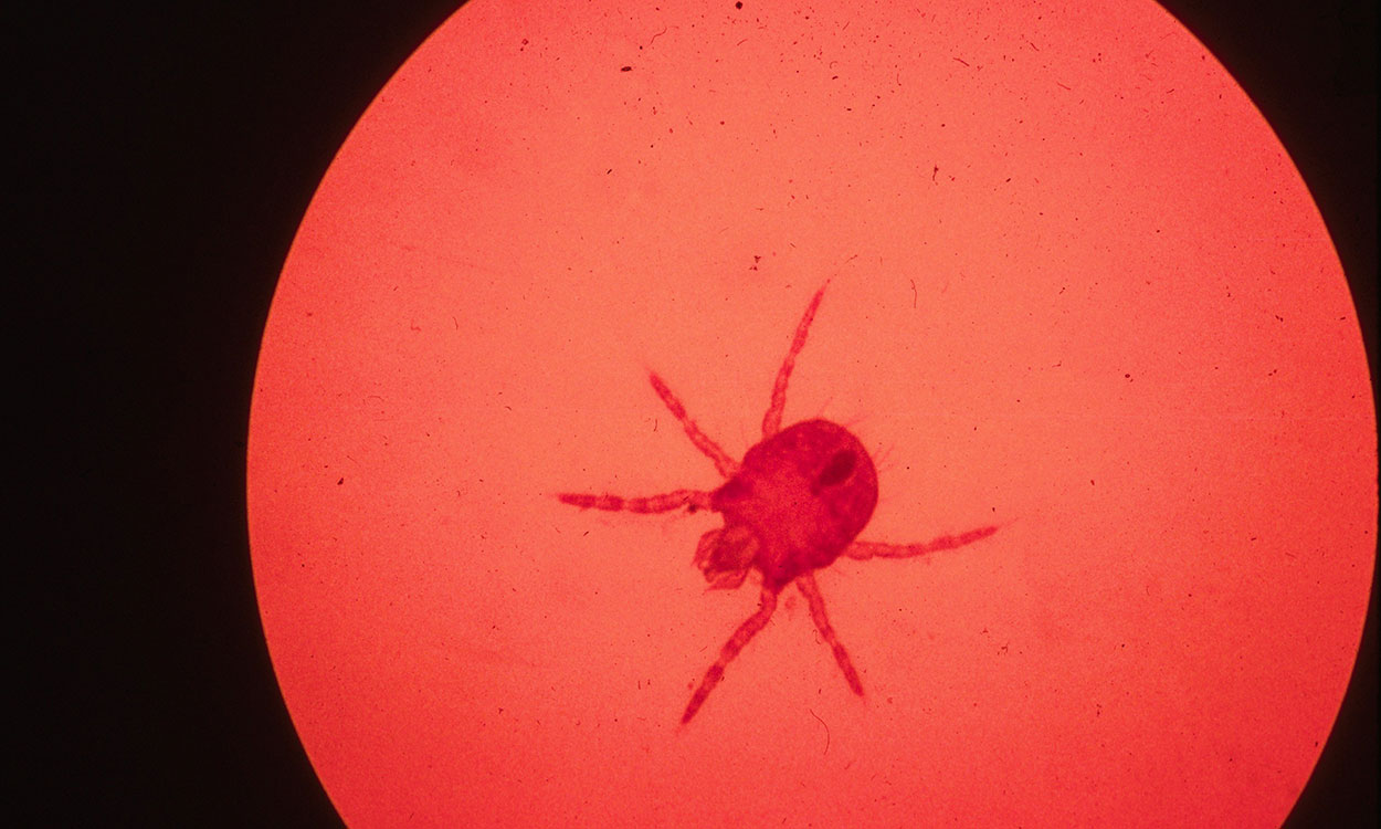 Chigger mite under maginifying device.