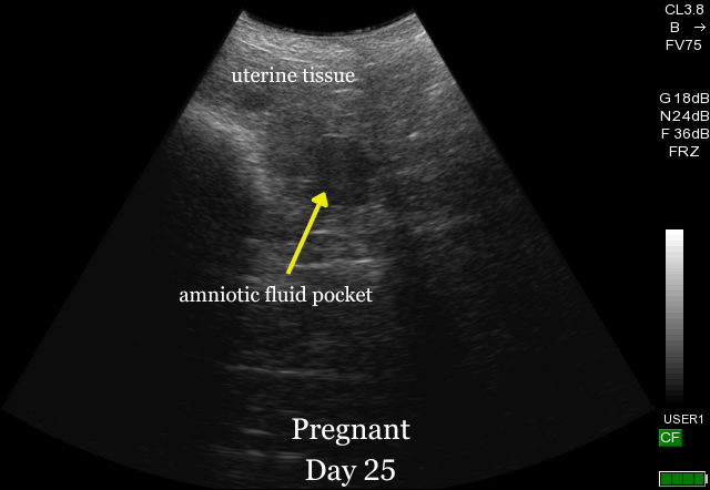 Pregnant sheep ultrasound at day 25 Pregnant sheep ultrasound day 25