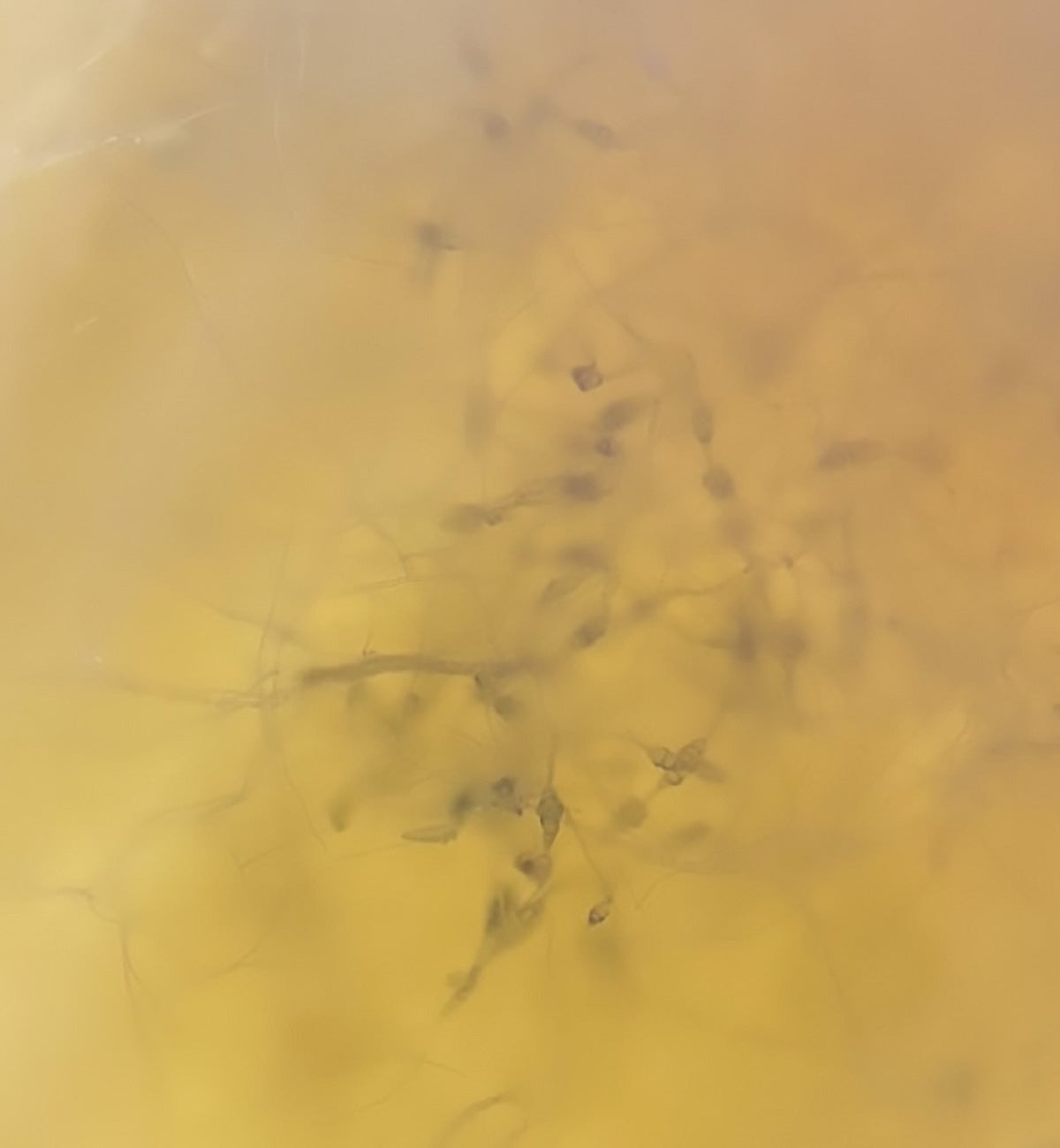 Close-up view of Alternaria conidia spores under a microscope.
