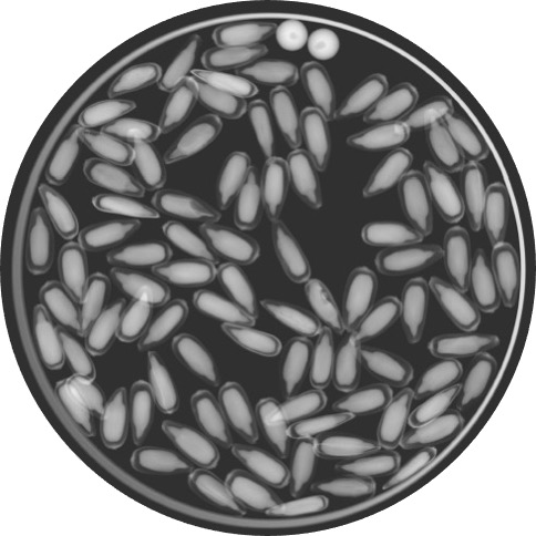 Black circular, x-ray image with light colored sunflower seeds within