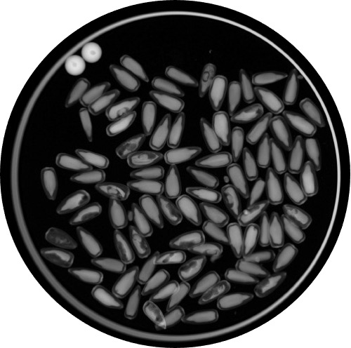 Black circular, x-ray image with light-colored sunflower seeds within.
