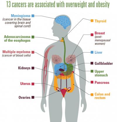 Diagram showing 13 cancers linked to overweight and obesity. Contact Nikki Prosch at 605-882-5140 for more information.