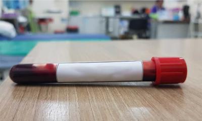 Blood sample sitting on a countertop in a veterinary lab.