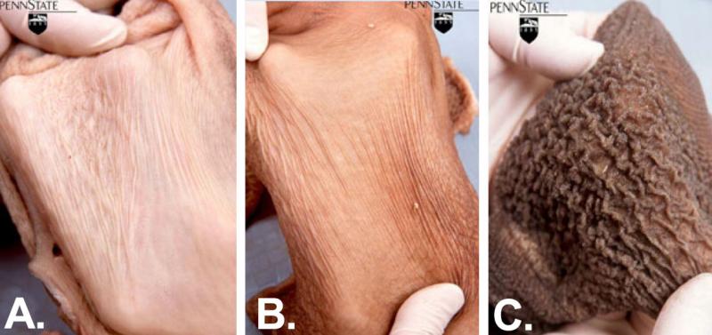 A diagram with three skin surfaces labeled A, B, and C. A is pink and smooth. B is pink, smooth with a few wrinkles. C is rough, brown with wrinkles throughout.