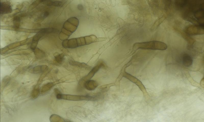 Embellisia allii. fungus spores under a microscope.