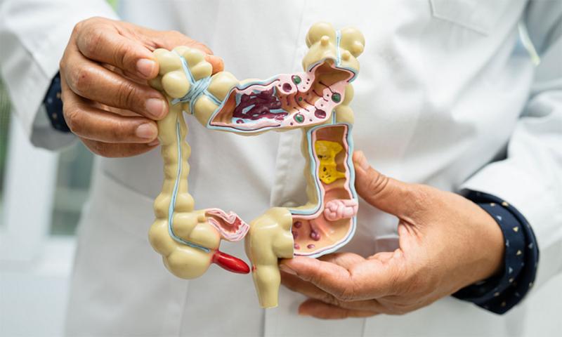 Doctor holding an anatomical model of the human digestive system.