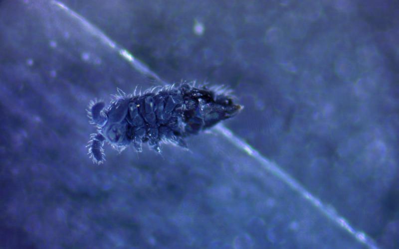 Magnified image of a springtail that is hairy and dark blue in color.
