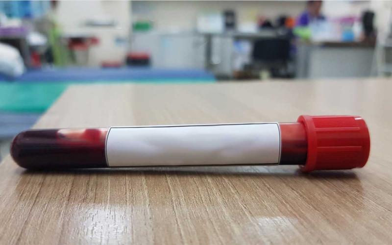 Blood sample sitting on a countertop in a veterinary lab.
