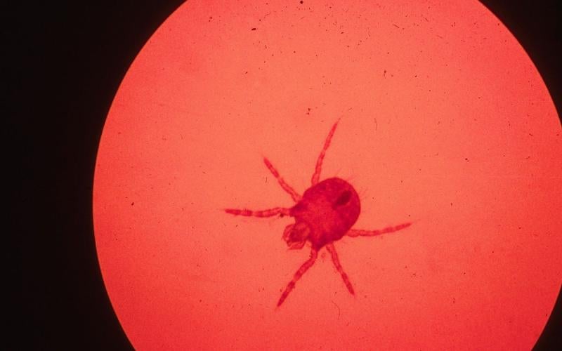 Chigger mite under maginifying device.
