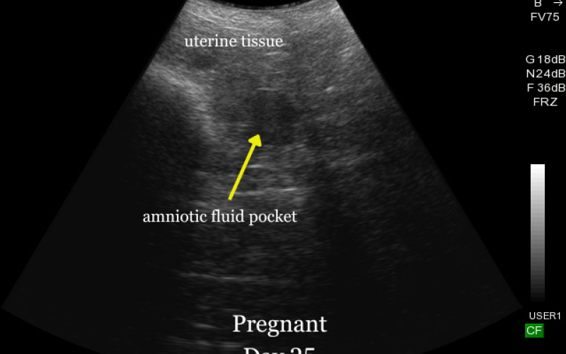 Pregnant sheep ultrasound day 25